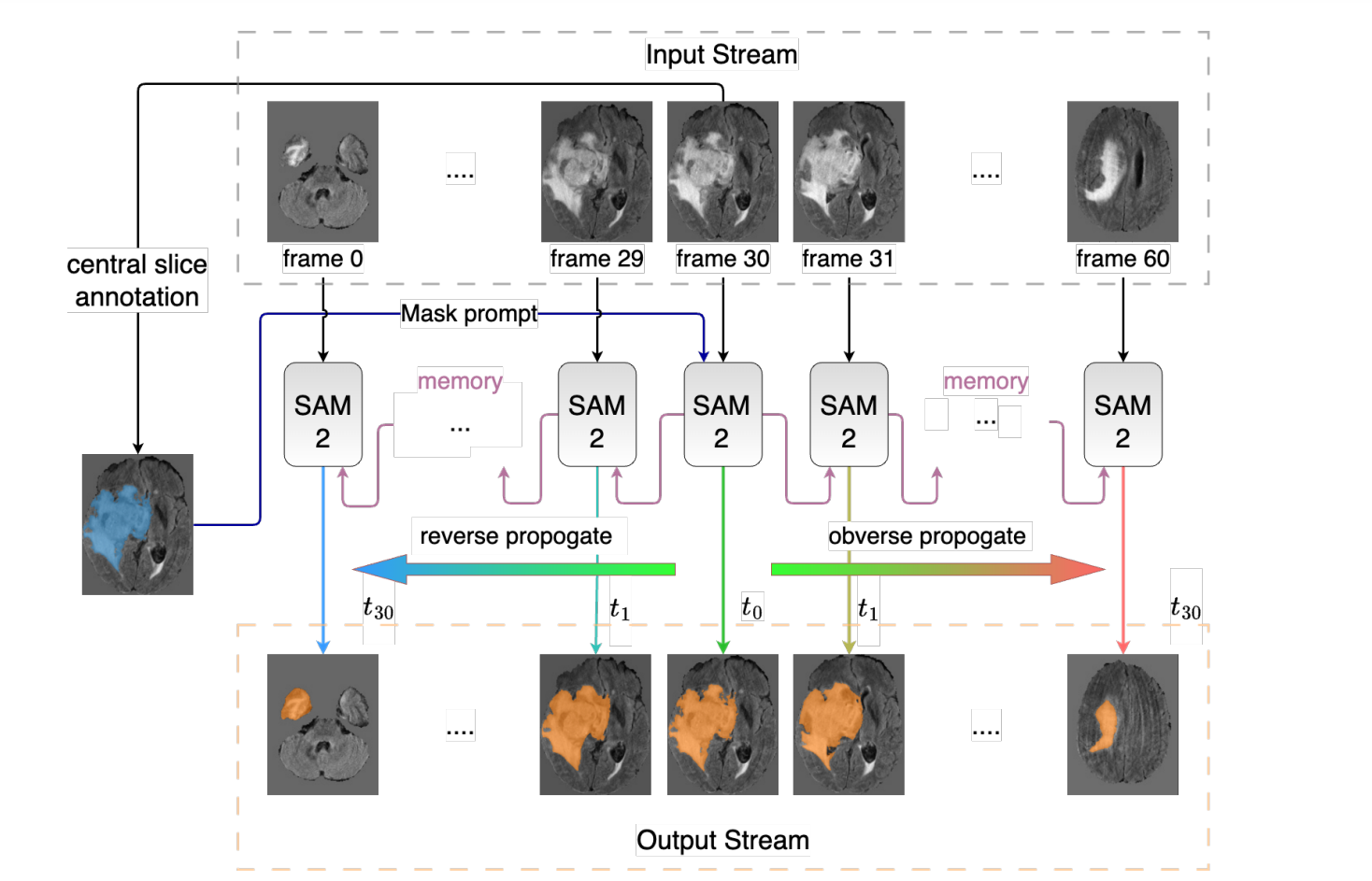 Interactive 3D Medical Image Segmentation with SAM 2
